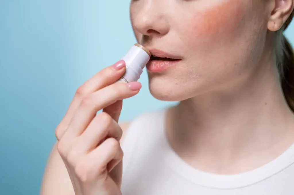 Labios